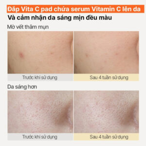 Vitamin C Pad dưỡng sáng da 60 miếng INNISFREE Vitamin C Pad Green T