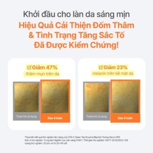 INNISFREE x [Live] Serum Vitamin C sáng da, mờ thâm mụn INNISFREE Gr