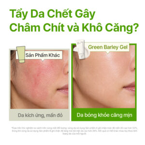 INNISFREE Green Barley Peeling Gel set - ảnh nguồn HAR
